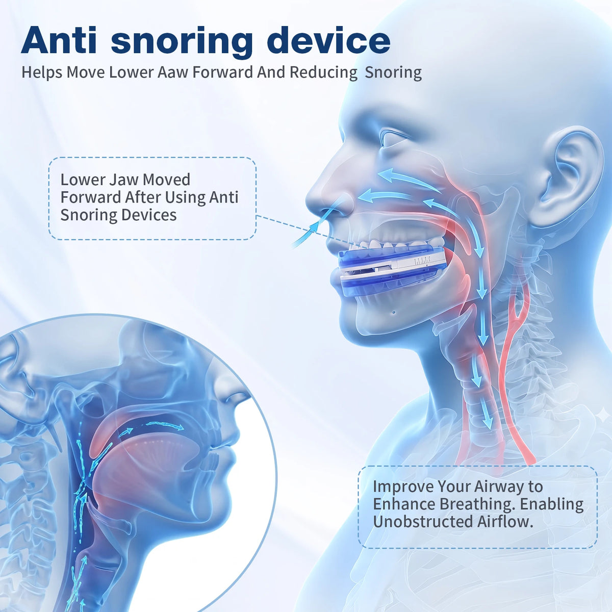 Adjustable Anti Snoring Mouthpiece Custom Fit Night Guard For Adults
